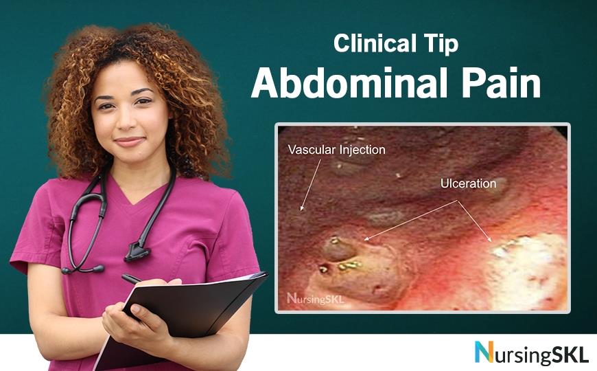 A 23yearold woman presents with left lower quadrant pain and a 10